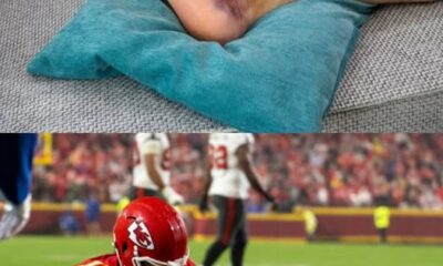 BREAKING: “5 minutes ago, Chiefs’ QB Patrick Mahomes officially announced his retirement due to a severe injury.”