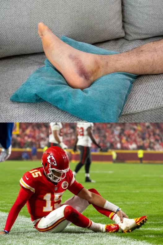 BREAKING: “5 minutes ago, Chiefs’ QB Patrick Mahomes officially announced his retirement due to a severe injury.”