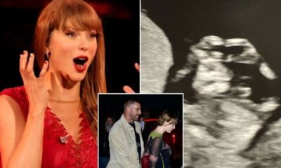 Breaking: Congratulations to Taylor Swift and Travis Kelce as They Make It Official! Taylor Announces Her Pregnancy by Posting Scan Results on Social Media, Revealing the Baby’s Gender – and Shares That After the Eras Tour Ends, She and the Baby’s Father, Travis, Will Be…