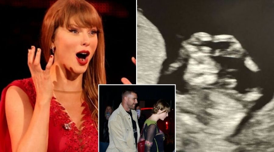 Breaking: Congratulations to Taylor Swift and Travis Kelce as They Make It Official! Taylor Announces Her Pregnancy by Posting Scan Results on Social Media, Revealing the Baby’s Gender – and Shares That After the Eras Tour Ends, She and the Baby’s Father, Travis, Will Be…