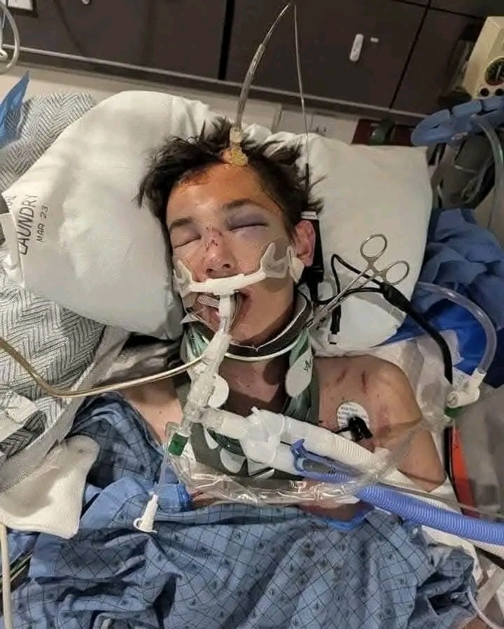 Breaking: Trevor is 17 & a senior @ Hurricane High School, he was in a horrible dirt bike accident on Sunday evening and is … See more