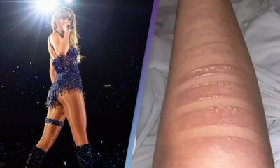 Taylor Swift rushed to the hospital for second degree burn from cooking for Travis Kelce...Full details