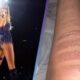 Taylor Swift rushed to the hospital for second degree burn from cooking for Travis Kelce...Full details