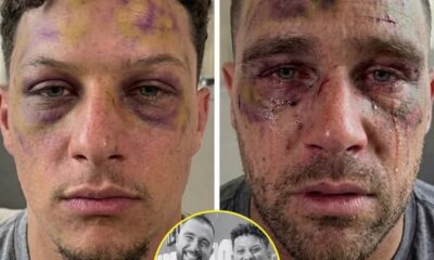 BREAKING: Serious Incident at the Mahomes Residence — Travis Kelce Faces Severe … After Deadly Dispute with Patrick Mahomes. Early this morning, police swarmed the home of football star Patrick Mahomes after a domestic dispute escalated into an unthinkable act of violence. Reports indicate that Travis Kelce has been confirmed…