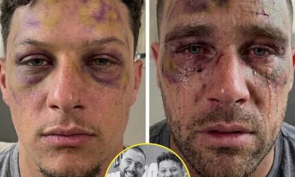 BREAKING: Serious Incident at the Mahomes Residence — Travis Kelce Faces Severe … After Deadly Dispute with Patrick Mahomes. Early this morning, police swarmed the home of football star Patrick Mahomes after a domestic dispute escalated into an unthinkable act of violence. Reports indicate that Travis Kelce has been confirmed…